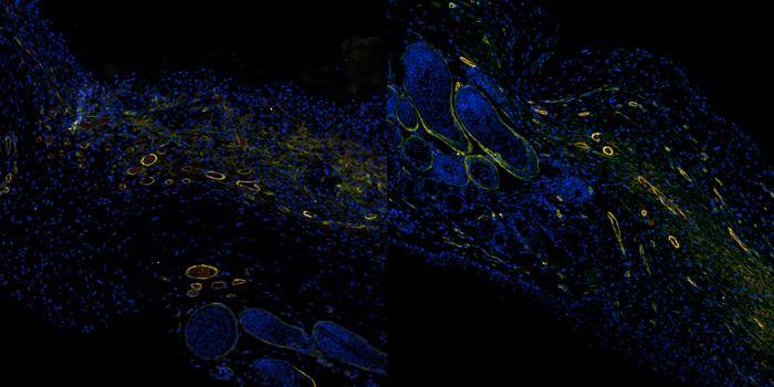 Sistema con inteligencia artificial permite monitorear cicatrización de heridas de forma objetiva Sistema con inteligencia artificial permite monitorear cicatrización de heridas de forma objetiva