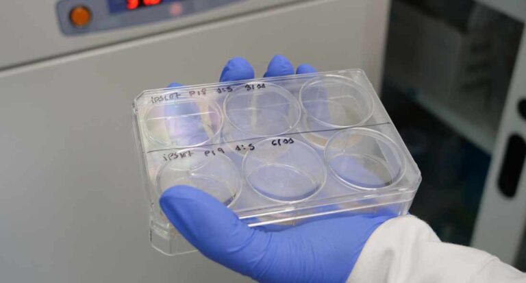 Universidad de Alicante desarrolla aplicaciones clínicas de espectrometría de masas para detectar enfermedades en etapas tempranas Universidad de Alicante desarrolla aplicaciones clínicas de espectrometría de masas para detectar enfermedades en etapas tempranas